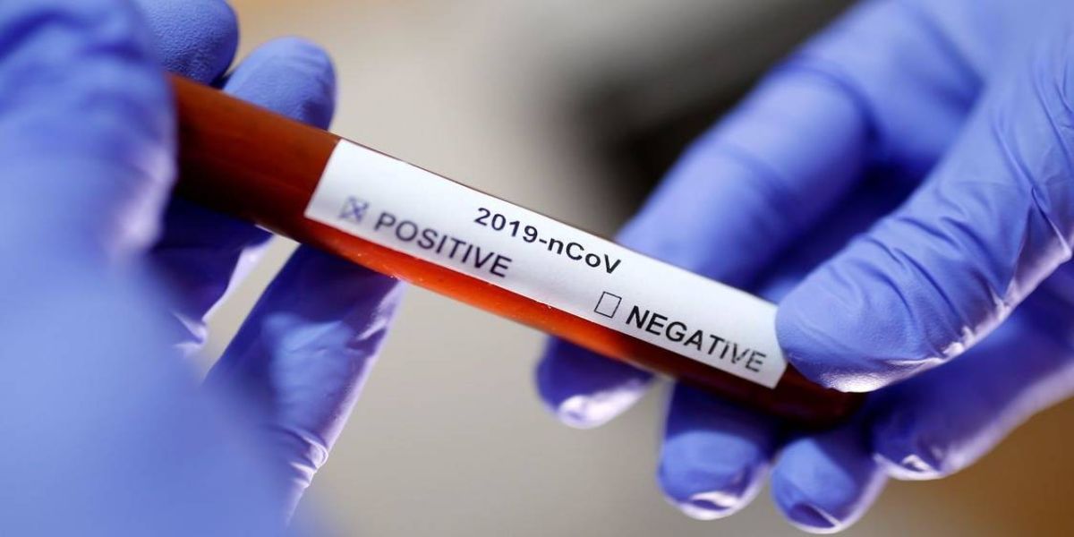 Brasil tem 43 mil casos de coronavírus e 2,7 mil mortes registradas