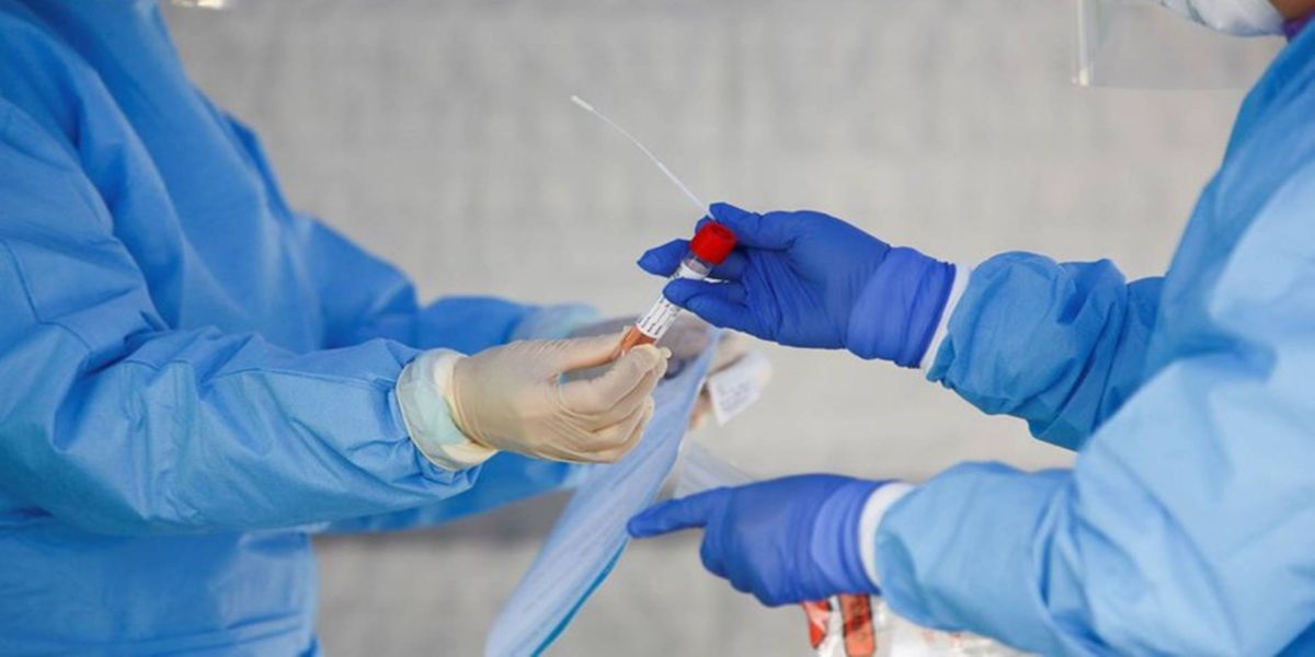 Saúde vai adquirir mais 46 milhões de testes de diagnóstico do novo coronavírus