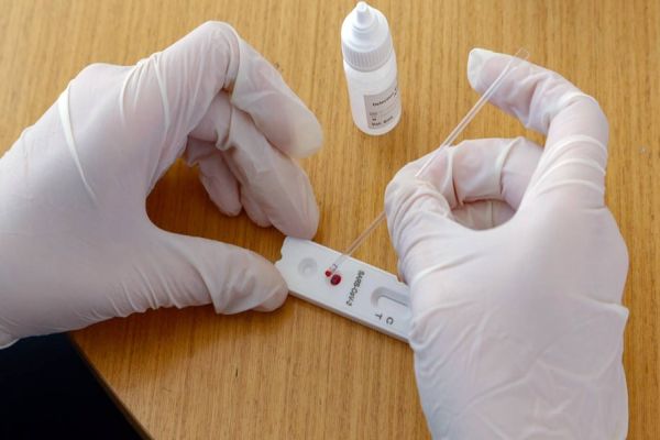 Coronavírus alcança 33% das cidades do Paraná