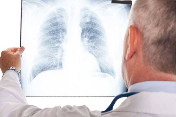 Boletim mostra tendência de aumento em casos de internação por Síndrome Respiratória Aguda Grave