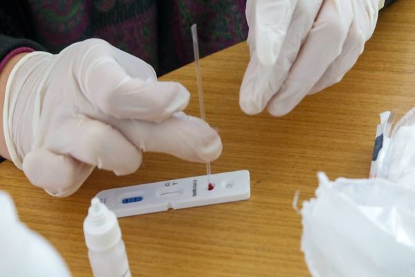 Paraná distribui mais 178 mil testes rápidos aos municípios