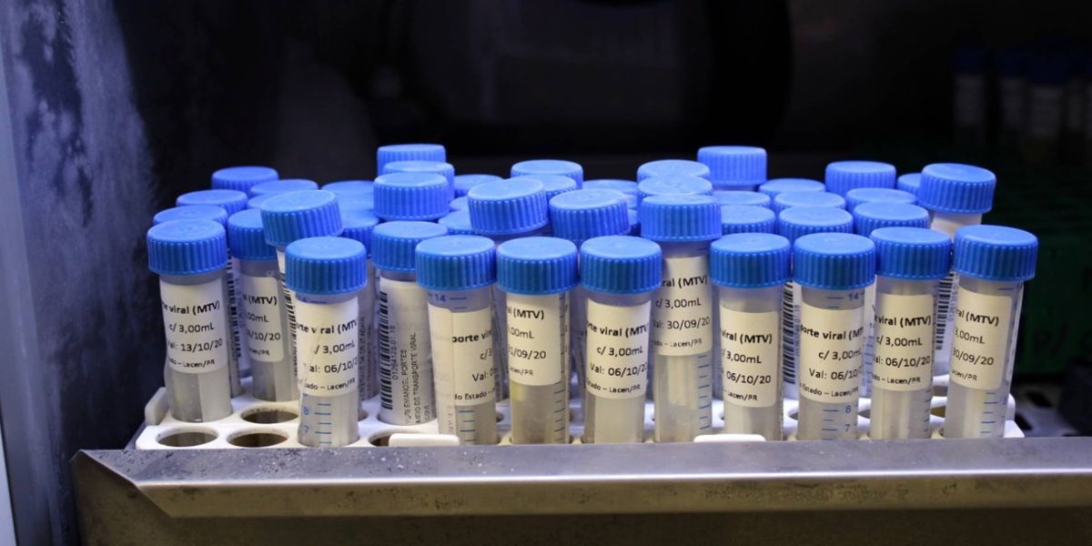 Laboratório Central de Cascavel realiza os primeiros testes para a Covid-19