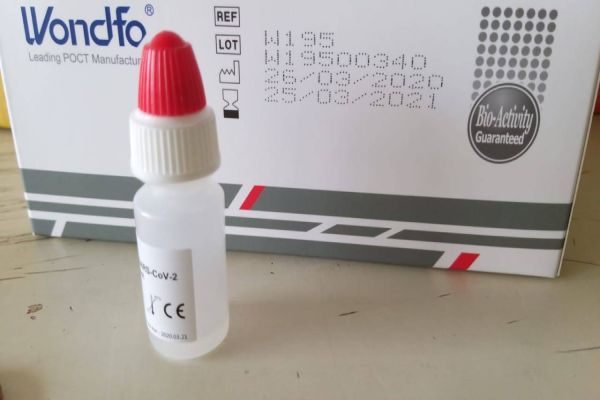 Polícia Militar de Cascavel recebe testes rápidos do novo Coronavírus