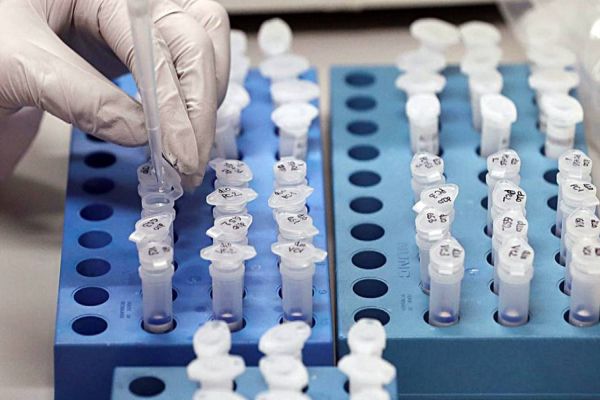 Covid-19: Brasil passa de 250 mil casos confirmados