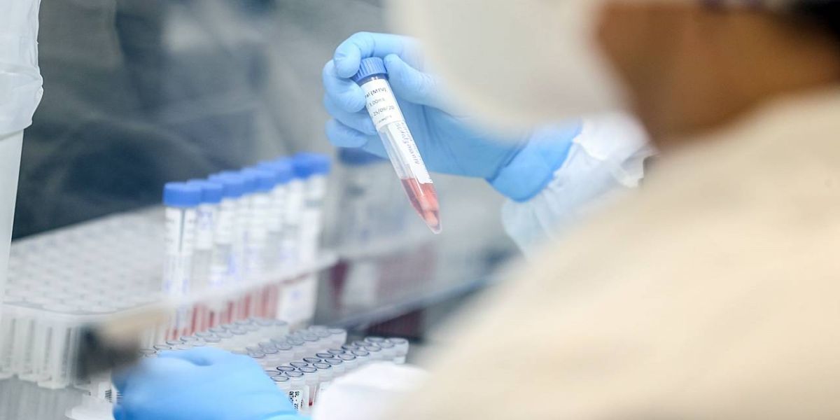 Reforço no Interior e mais testes são estratégicos contra o coronavírus