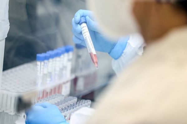 Reforço no Interior e mais testes são estratégicos contra o coronavírus