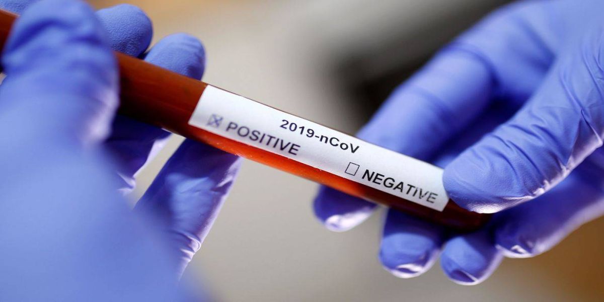 Coronavírus: 125.960 pessoas estão recuperadas no Brasil