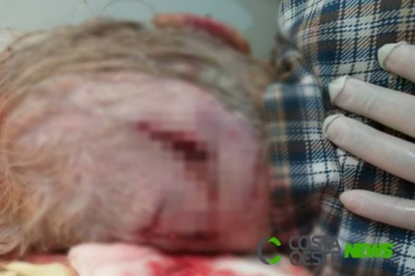 Idosa é agredida com cadeira e tem objetos roubados em Guaíra; suspeito foi preso