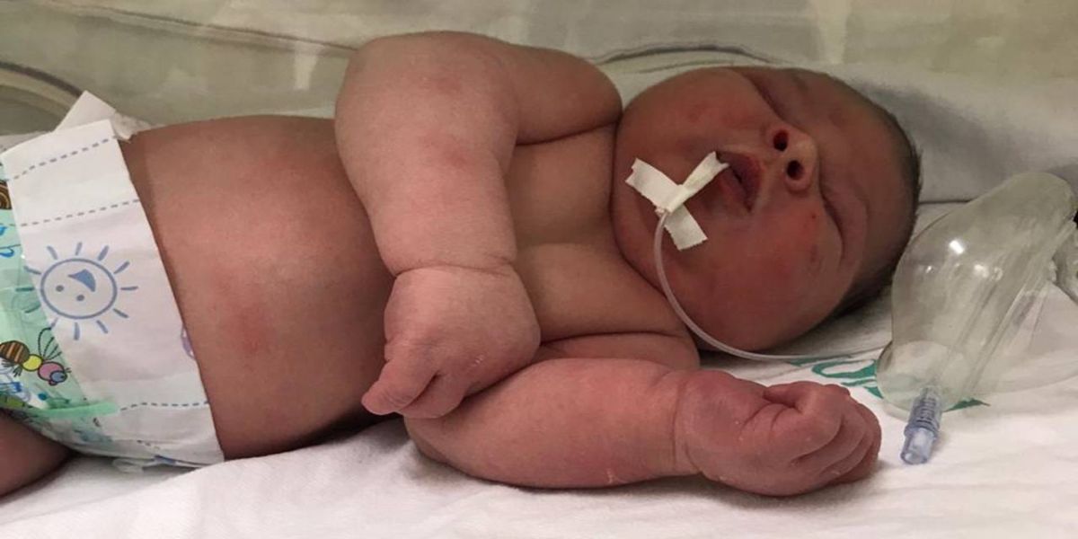 Inusitado: Bebê nasce com aproximadamente 5,2 quilos no Hospital Universitário