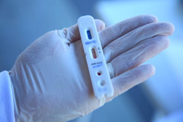 Secretaria de Saúde esclarece sobre realização de teste para Covid-19 em farmácias