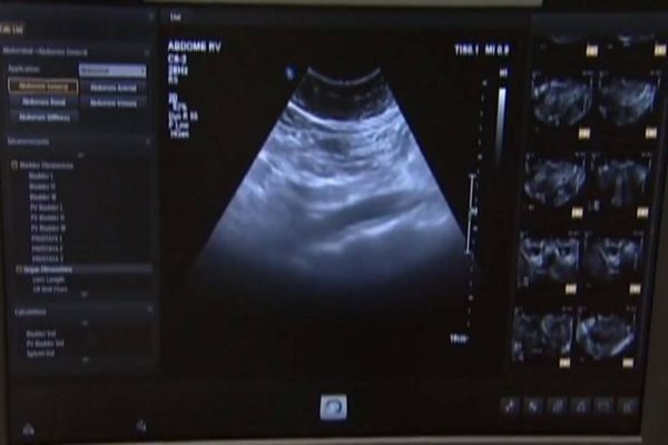 Comissão debate uso de ultrassonografia pulmonar no diagnóstico de Covid-19