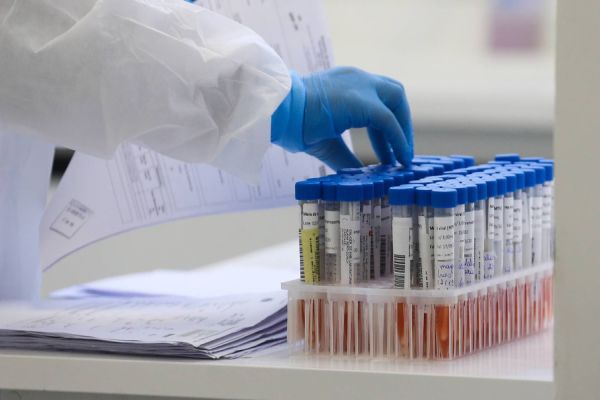 Casos de Covid-19 sobem 60% em uma semana e óbitos caem 23%