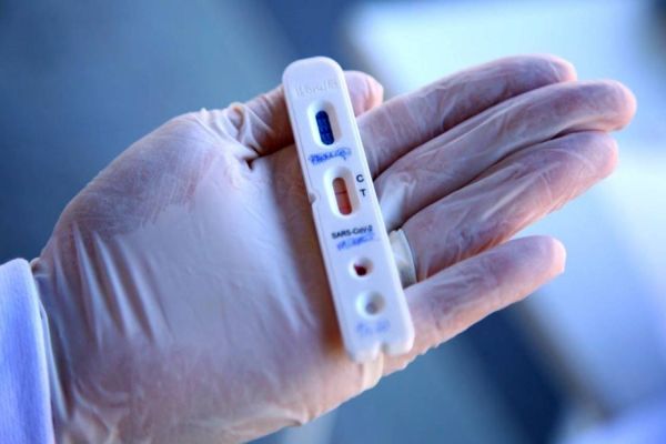 Pesquisadores farão testes rápidos de Covid-19 em Cascavel