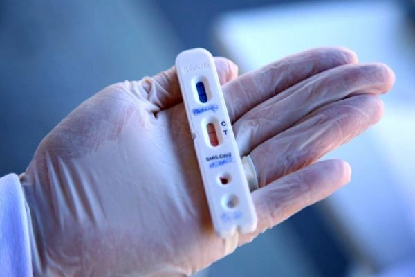 Pesquisadores aplicarão testes rápidos em 250 pessoas em Cascavel