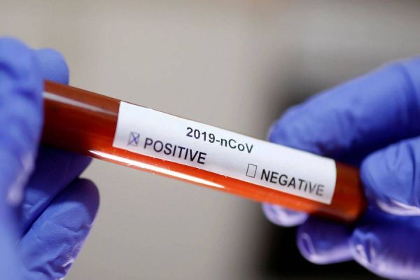 Cascavel registra mais 53 testes positivos para Covid-19, e chega 737 confirmados