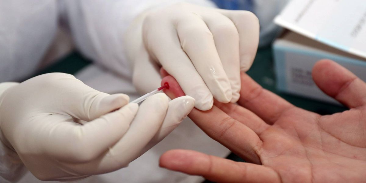 EpiCovid-19: Pesquisadores aplicarão testes rápidos em Cascavel