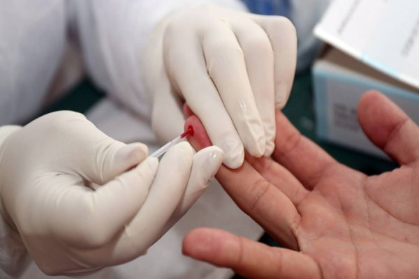 EpiCovid-19: Pesquisadores aplicarão testes rápidos em Cascavel