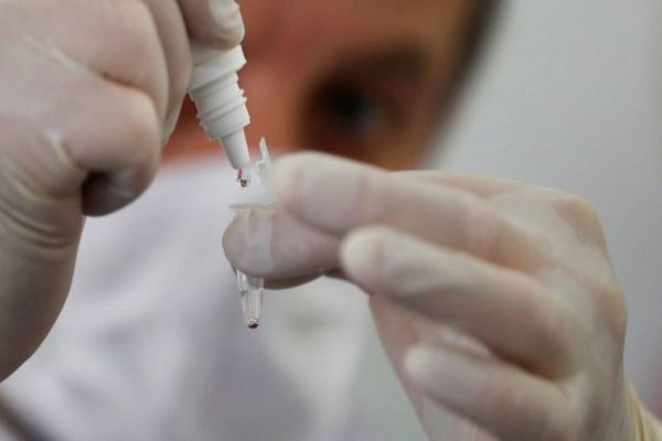 Planos de saúde são obrigados a cobrir teste sorológico para COVID-19
