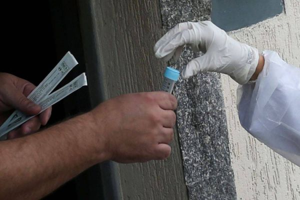 Justiça suspende compra de 100 mil testes para detectar covid-19 no DF