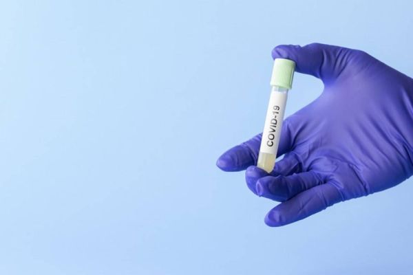 Laboratórios públicos ampliam em 869% capacidade de testagem