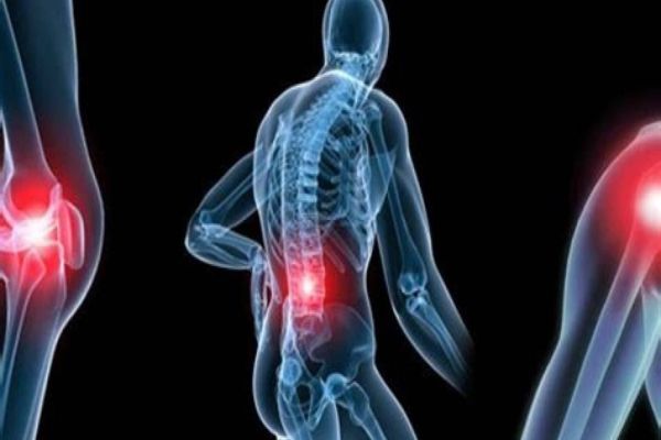 Julho Amarelo: diagnóstico precoce de câncer ósseo é fundamental