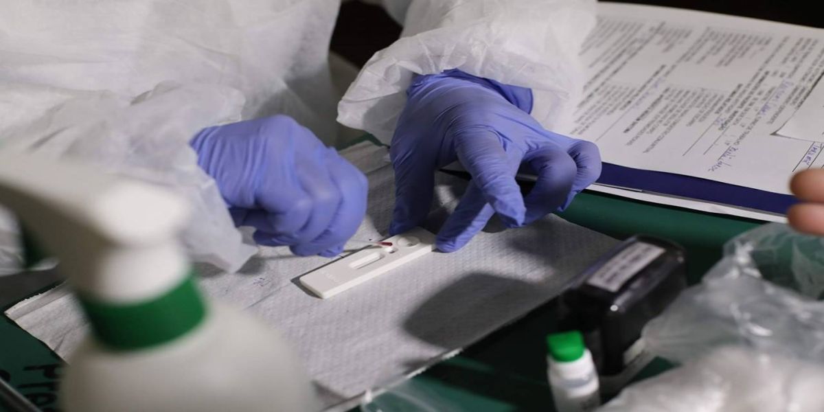 Casos positivos de Covid-19 tem queda na primeira quinzena de julho