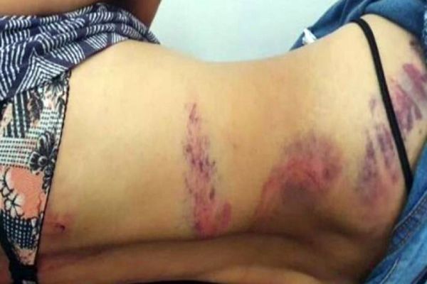 Mulher é torturada por quase 24 horas pelo ex-marido, na frente dos sogros