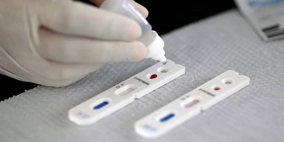 Secretaria de Saúde esclarece sobre testagens para Covid-19