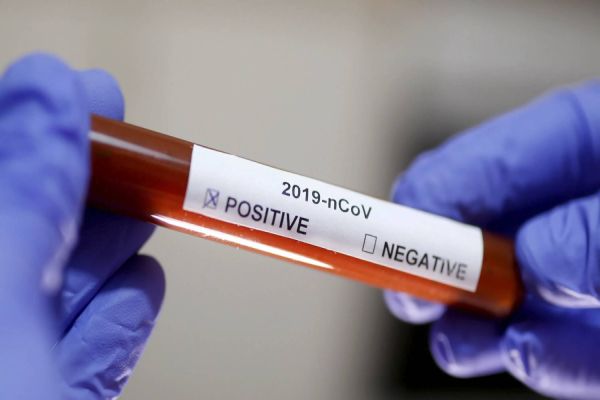 Paraná é o segundo estado que mais realiza exames RT-PCR