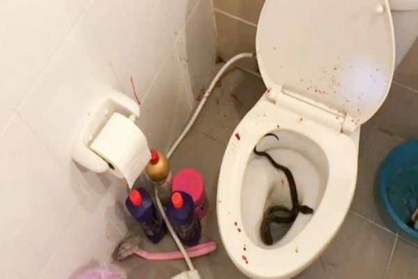 Jovem é picado no pênis por cobra de um metro enquanto usava o banheiro