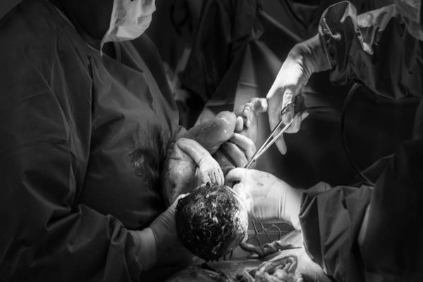 Projeto prevê presença de enfermeiras obstetras em todas as maternidades da rede pública e privada