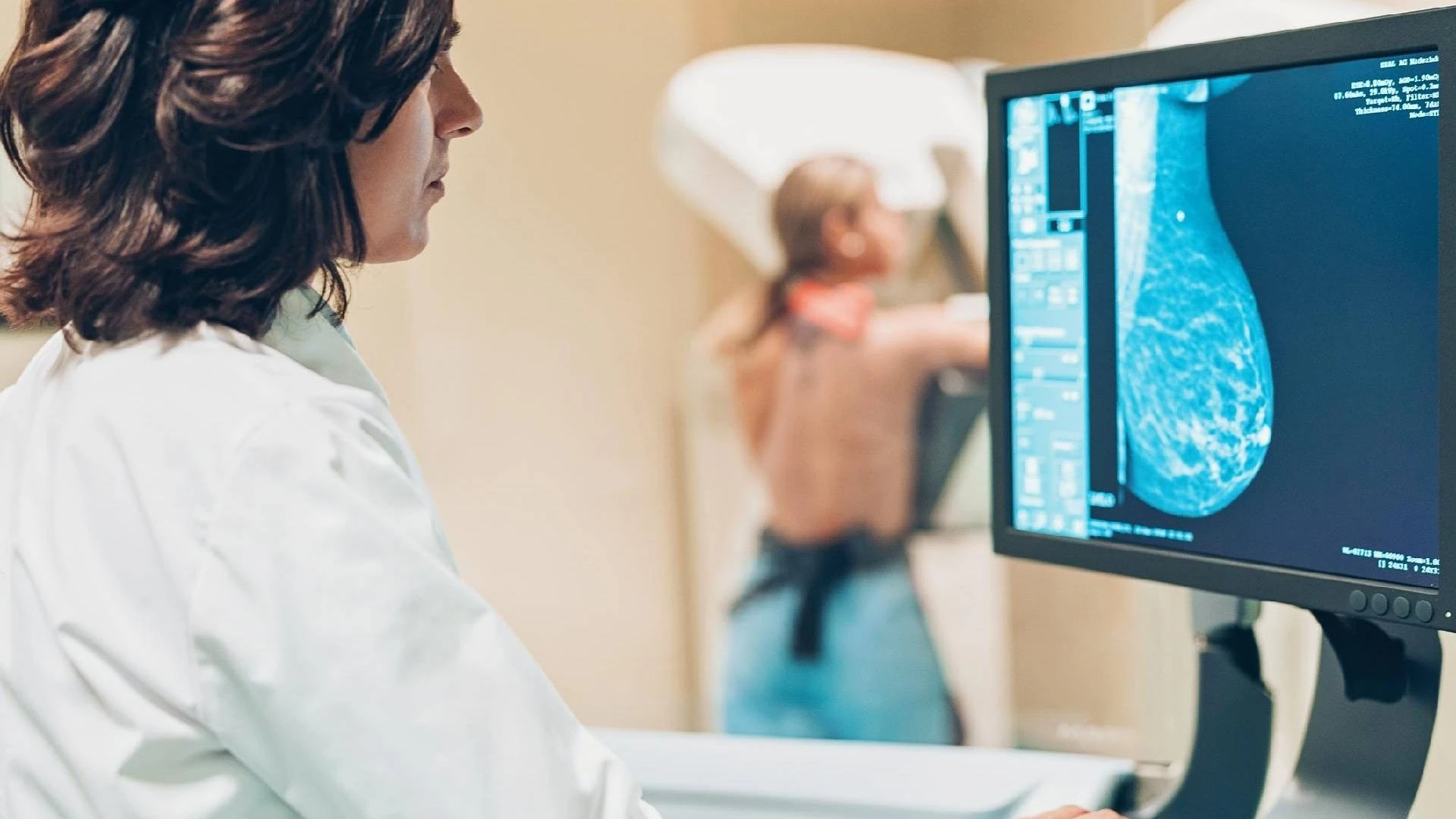 Foto relacionada a notícia: Uopeccan promove agendamento de mamografias pela internet; saiba como funciona
