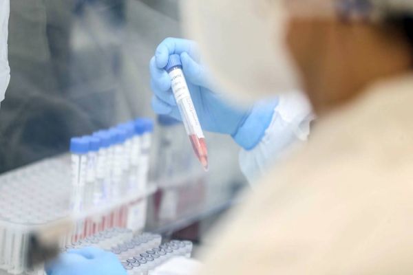 Saúde confirma cinco casos de infectados com a variante brasileira da Covid-19