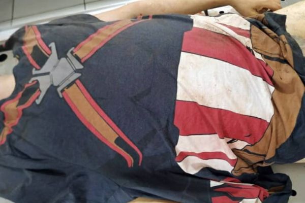 Imagem referente a notícia: Delegacia de Homicídios fala sobre achado de cadáver e pede ajuda para identificar