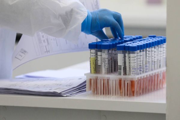 Paraná confirma primeira reinfecção pelo coronavírus