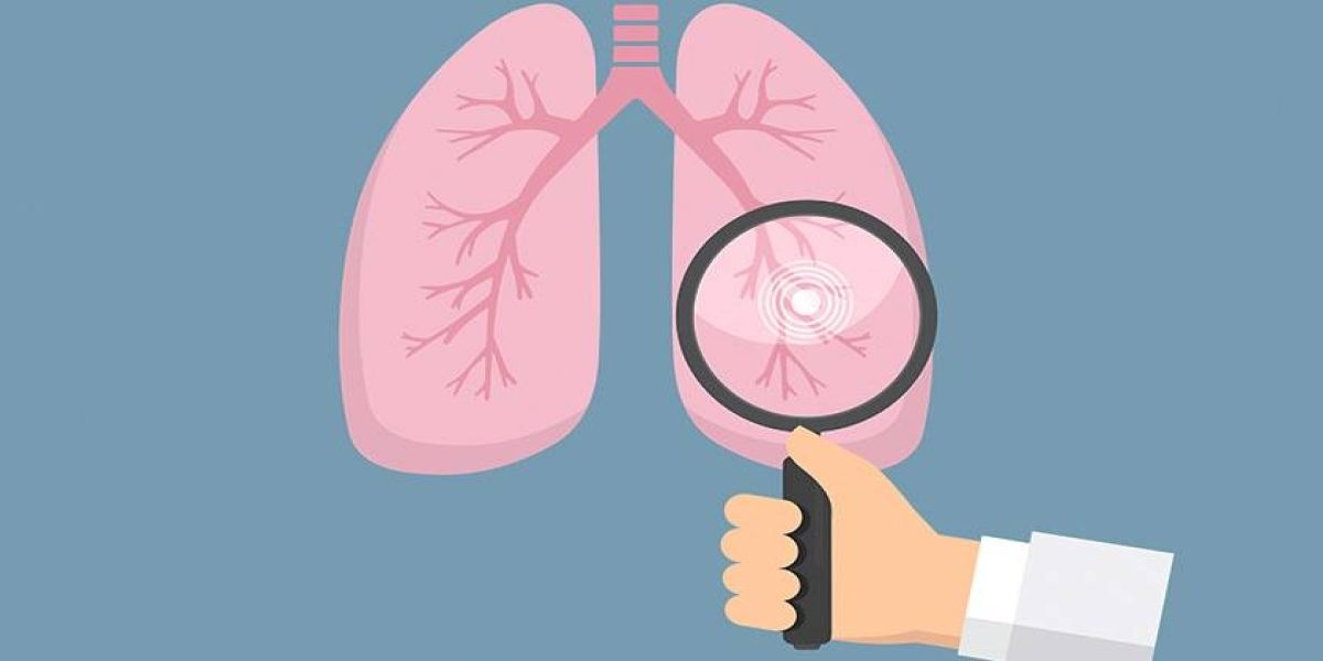 No dia Mundial da Tuberculose, Saúde chama atenção para cuidados com a doença