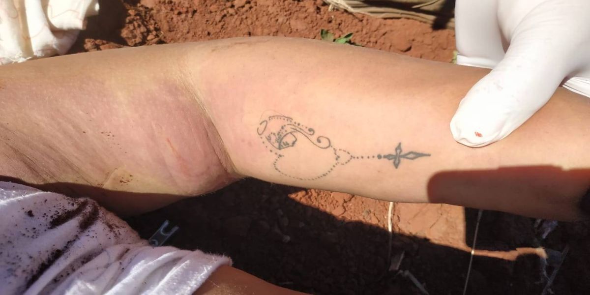 DH divulga imagens que podem auxiliar na identificação de mulher encontrada em estrada rural