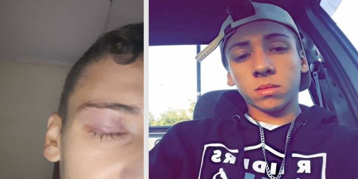 Jovem pede ajuda para custear cirurgia ocular após acidente em partida de futebol