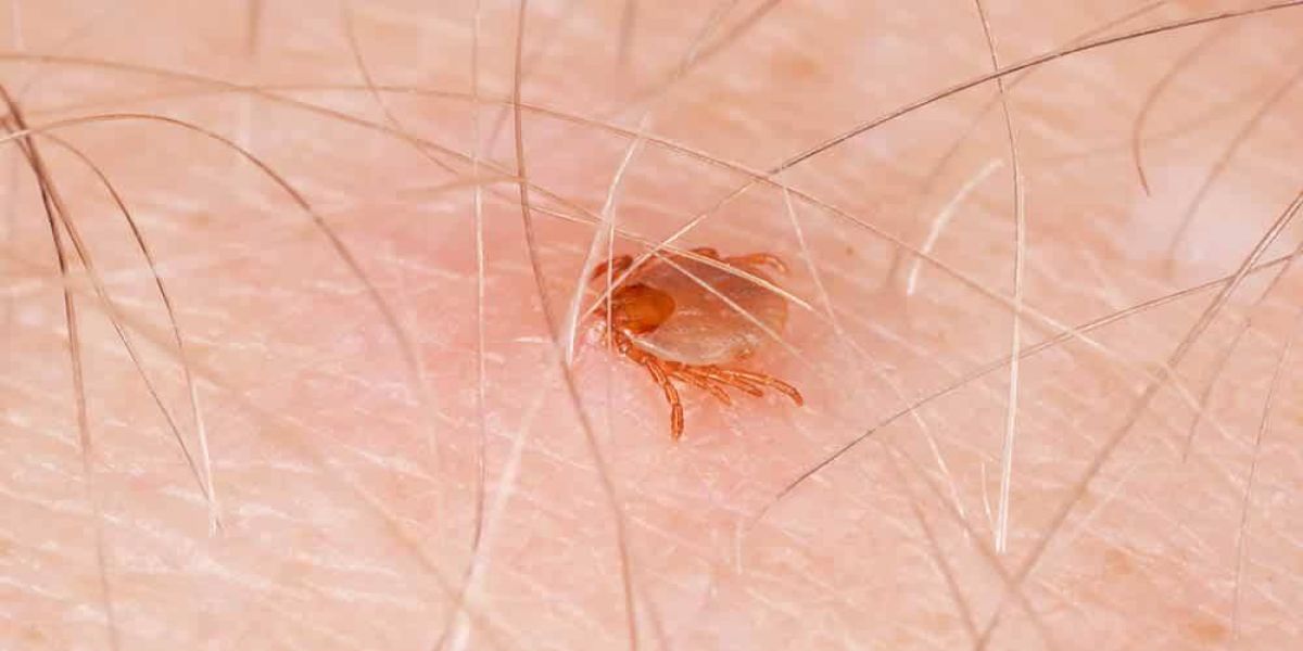 Vereador de Cascavel pede atenção à possível infestação de carrapatos e surto de febre maculosa