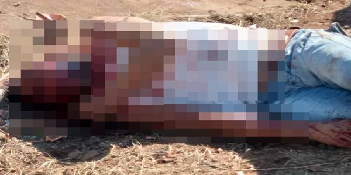 Vendedor de picolé é vítima de agressões graves no Bairro Fátima em Ibema