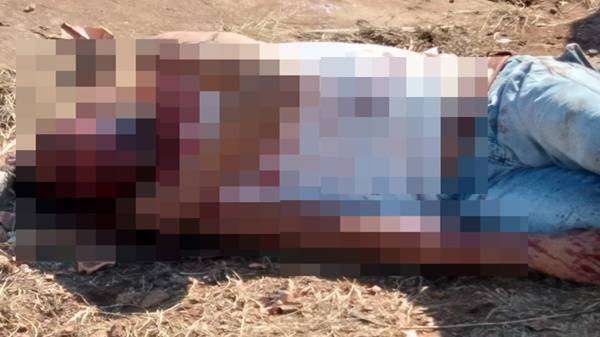 Vendedor de picolé é vítima de agressões graves no Bairro Fátima em Ibema