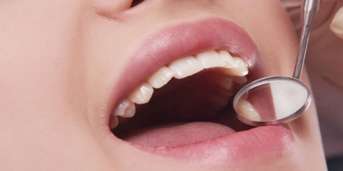 Estimativa revela mais de 15 mil novos casos de câncer de boca por ano no Brasil