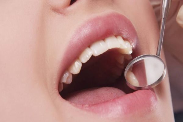 Estimativa revela mais de 15 mil novos casos de câncer de boca por ano no Brasil