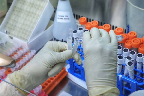 Covid-19: Paraná confirma o primeiro caso da cepa indiana e Cascavel segue com um suspeito também