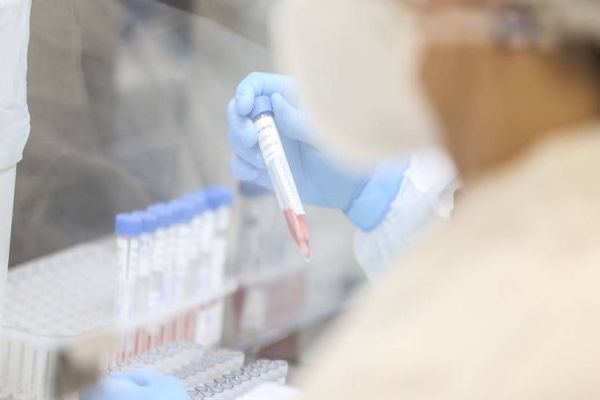 Atenção: Primeiro caso da variante Lambda é confirmado no Paraná