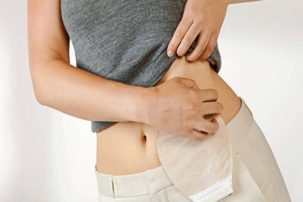 Medo e adaptação: a importância do apoio aos pacientes ostomizados
