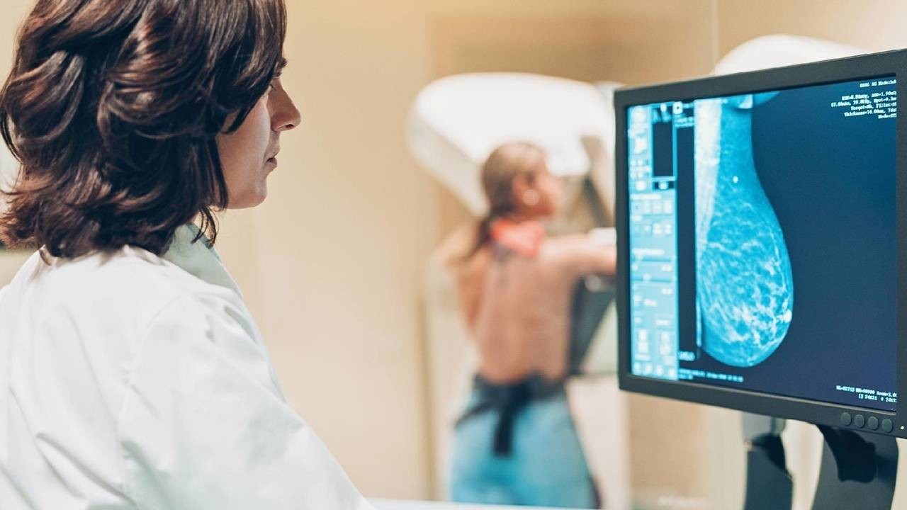 CEONC possui grande volume de mamografias gratuitas disponíveis