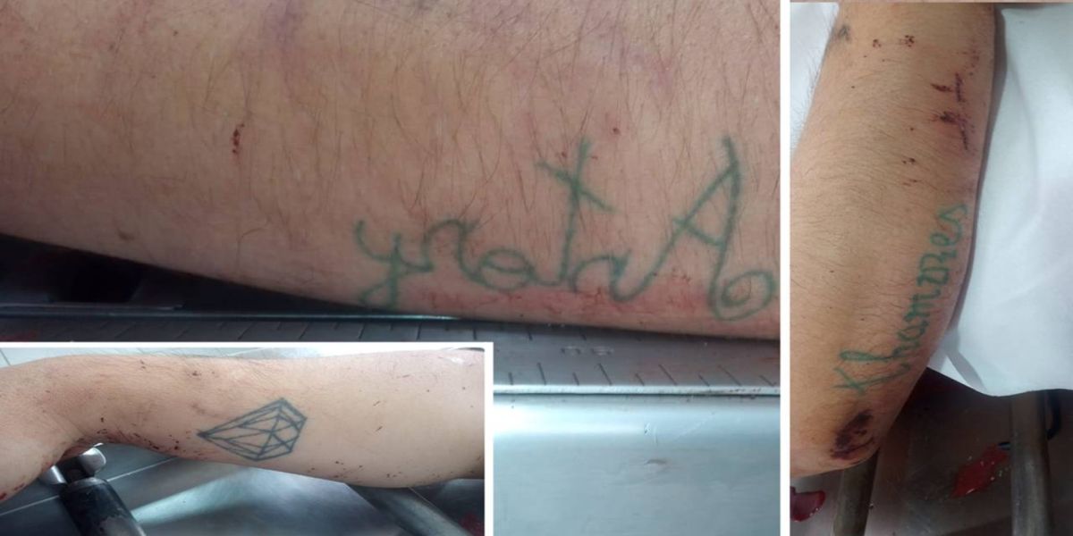 Você conhece? Policia Civil divulga imagens de tatuagens da vítima de homicídio na Rua Rio da Paz