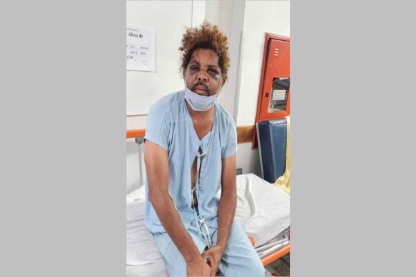 Morador de rua agredido por personal pede vaga em abrigo e teme represálias