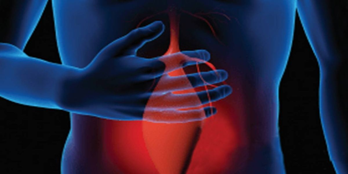 O que é o aneurisma de aorta e os riscos da doença; Entenda